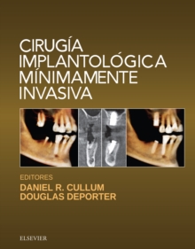 Image for Cirugía Implantológica Mínimamente Invasiva