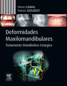 Image for Deformidades Maxilo-mandibulares: Tratamento Ortodontico -cirurgico