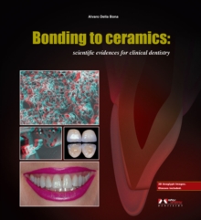 Image for Bonding to Ceramics