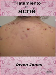 Image for Tratamiento Del Acne