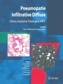 Image for Pneumopatie Infiltrative Diffuse : Clinica, Anatomia Patologica, HRTC