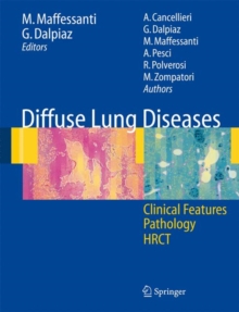 Image for Diffuse Lung Diseases