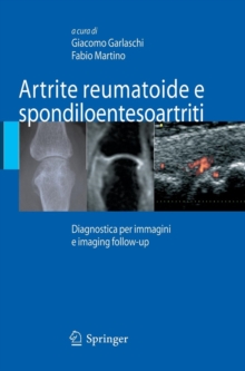 Image for Artrite reumatoide e spondiloentesoartriti