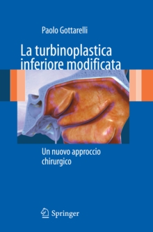 Image for La turbinoplastica inferiore modificata: Un nuovo approccio chirurgico