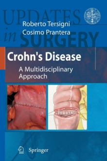 Image for Crohn's Disease