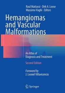 Image for Hemangiomas and Vascular Malformations