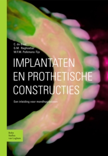 Image for Implantaten en prothetische constructies: Een inleiding voor mondhygienisten