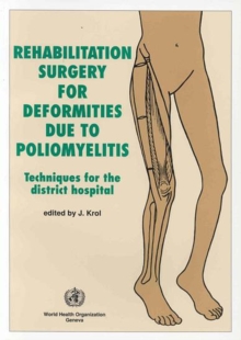 Image for Rehabilitation surgery for deformities due to poliomyelitis