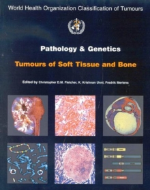 Image for Pathology and Genetics of Tumours of Soft Tissue and Bone