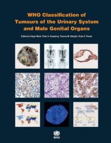 WHO classification of tumours of the urinary system and male genital organs