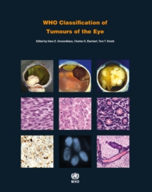 Image for WHO Classification of Tumours of the Eye