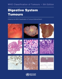 Image for WHO Classification of Tumours. Digestive System Tumours : WHO Classification of Tumours, Volume 1