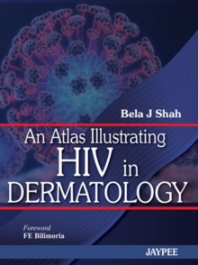 Atlas Illustrating HIV in Dermatology