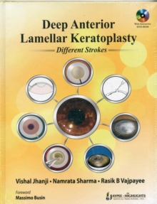 Image for Deep Anterior Lamellar Keratoplasty Different Strokes