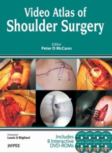 Image for Video Atlas of Shoulder Surgery