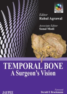 Temporal Bone