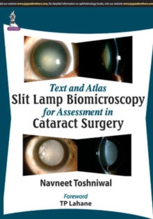 Image for Text and Atlas: Slit Lamp Biomicroscopy for Assessment in Cataract Surgery