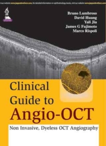 Image for Clinical guide to angio-OCT  : non invasive, dyless OCT angiography