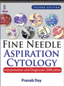 Image for Fine Needle Aspiration Cytology: Interpretation and Diagnostic Difficulties