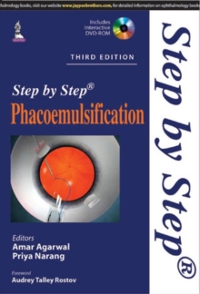 Image for Step by Step Phacoemulsification