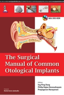 Image for The Surgical Manual of Common Otological Implants