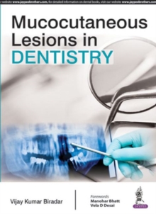 Image for Mucocutaneous lesions in dentistry