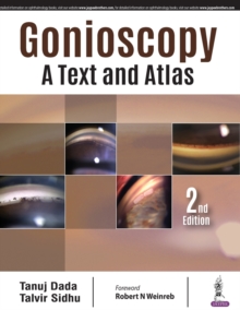 Image for Gonioscopy: A Text and Atlas