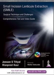 Small Incision Lenticule Extraction (SMILE): Surgical Technique and Challenges