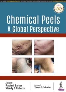 Image for Chemical peels  : a global perspective