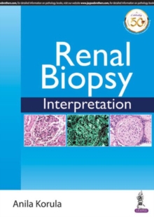 Image for Renal biopsy interpretation
