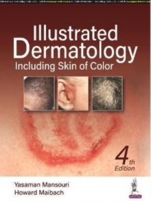 Image for Illustrated dermatology  : including skin of colour