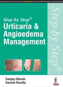 Step by Step: Urticaria & Angioedema Management