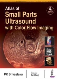 Image for Atlas of Small Parts Ultrasound : with Color Flow Imaging