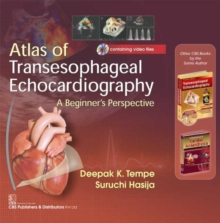 Image for Atlas of Transesophageal Echocardiography : A Beginners Perspective