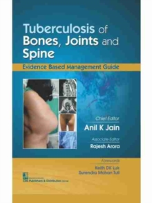 Tubercolosis of Bones, Joints and Spine