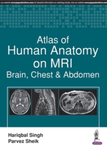 Image for Atlas of Human Anatomy on MRI : Brain, Chest & Abdomen