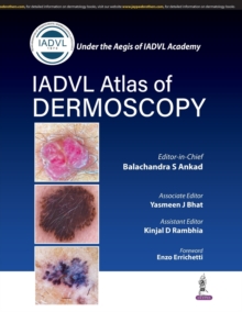Image for Atlas of Dermoscopy