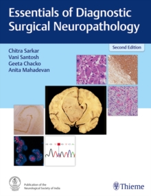Image for Essentials of Diagnostic Surgical Neuropathology