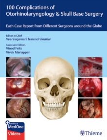 Image for 100 Complications of Otorhinolaryngology & Skull Base Surgery