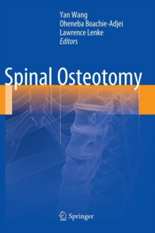 Image for Spinal osteotomy