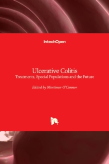 Image for Ulcerative Colitis