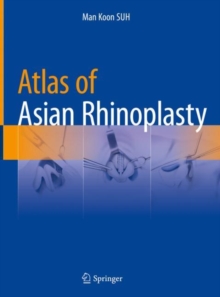 Atlas of Asian Rhinoplasty