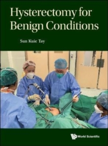 Image for Hysterectomy for benign conditions