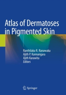Image for Atlas of Dermatoses in Pigmented Skin