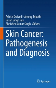 Image for Skin cancer  : pathogenesis and diagnosis