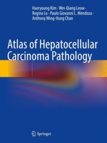 Image for Atlas of Hepatocellular Carcinoma Pathology