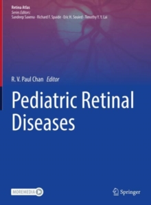 Image for Pediatric retinal diseases