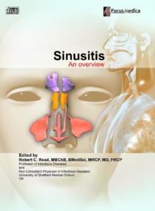 Image for Sinusitis