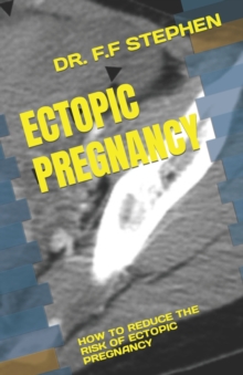 Image for Ectopic Pregnancy