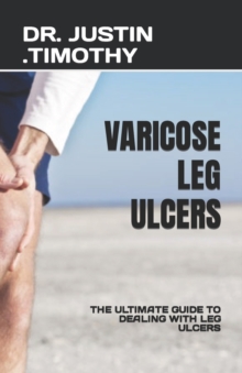 Image for Varicose Leg Ulcers : The Ultimate Guide to Dealing with Leg Ulcers